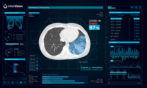 Analysis software - Beijing Infervision Technology Co. Ltd. - reporting / treatment / validation