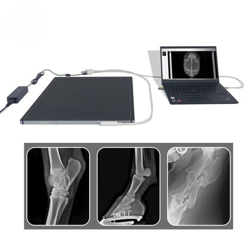 Multipurpose radiography flat panel detector - FTLFPD-V1717X - Fatali Medical - portable / 17 x 17