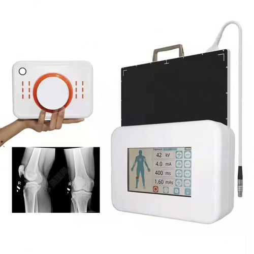 Digital X-ray system - FTLF360 - Fatali Medical - for multipurpose radiography / portable