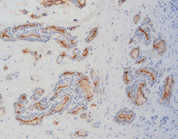 Solution reagent - FHM0010 - Celnovte Biotechnology Co., Ltd. - immunohistochemistry / for tumor markers / mouse-based