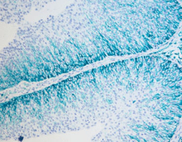 Stain reagent kit - SD8005 - Celnovte Biotechnology Co., Ltd. - tissue / immunohistochemistry