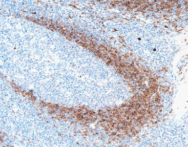 Staining solution reagent - CIR-0111 - Celnovte Biotechnology Co., Ltd. - antibody / stain / for cytology