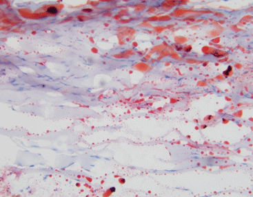 Stain reagent kit - Celnovte Biotechnology Co., Ltd. - for histology / lipid