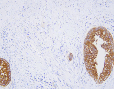 Monoclonal antibody - CCM-0833 - Celnovte Biotechnology Co., Ltd. - polyclonal antibody / for research / tissue