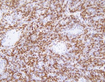 Antibody - CBM-0042 - Celnovte Biotechnology Co., Ltd. - cytogenetic / apoptosis