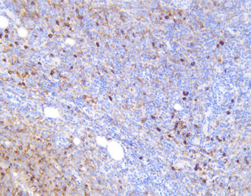 Monoclonal antibody - CKM-0014 - Celnovte Biotechnology Co., Ltd. - polyclonal antibody / for research / tissue
