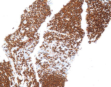Staining solution reagent - CCM-0461 - Celnovte Biotechnology Co., Ltd. - stain / antigen / tissue