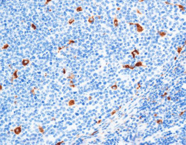 Antibody - CCM-0701 - Celnovte Biotechnology Co., Ltd. - staining solution / lysozyme / stain