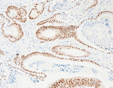 Staining solution reagent - CCR-0822 - Celnovte Biotechnology Co., Ltd. - antibody / stain / tissue