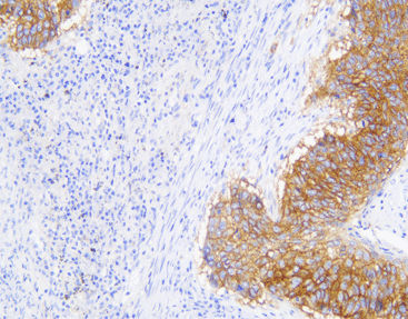 Staining solution reagent - CEM-0033 - Celnovte Biotechnology Co., Ltd. - stain / growth factor / clinical