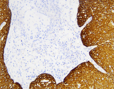 Staining solution reagent - CCM-0983 - Celnovte Biotechnology Co., Ltd. - antibody / stain / clinical