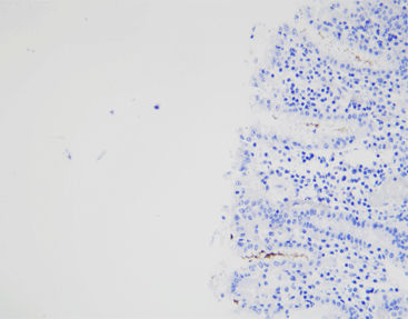 Staining solution reagent - CHM-0173 - Celnovte Biotechnology Co., Ltd. - antibody / stain / tissue