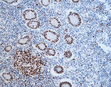 Staining solution reagent - CMM-0202 - Celnovte Biotechnology Co., Ltd. - antibody / stain / tissue