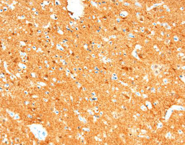 Staining solution reagent - CNM-0082 - Celnovte Biotechnology Co., Ltd. - antibody / stain / tissue