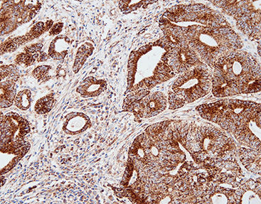 Staining solution reagent - CSM-0230 - Celnovte Biotechnology Co., Ltd. - antibody / stain / tissue