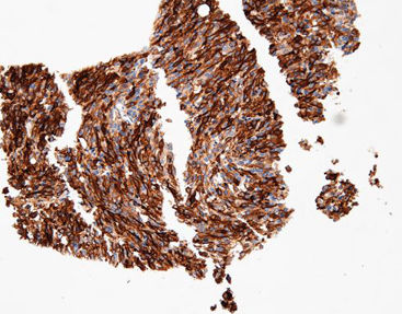 Staining solution reagent - CTM-0213 - Celnovte Biotechnology Co., Ltd. - antibody / stain / tissue