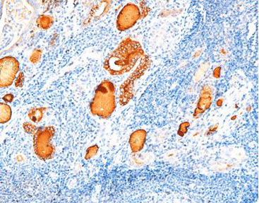 Staining solution reagent - CTM-0150 - Celnovte Biotechnology Co., Ltd. - antibody / stain / tissue