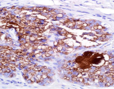 Staining solution reagent - CAR-0140 - Celnovte Biotechnology Co., Ltd. - antibody / stain / tissue