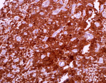 Staining solution reagent - CAM-0160 - Celnovte Biotechnology Co., Ltd. - antibody / stain / tissue