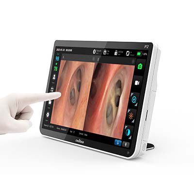 Endoscopy video processor - P1 - Endoso Life Technology - with USB port / with video monitor / with recorder