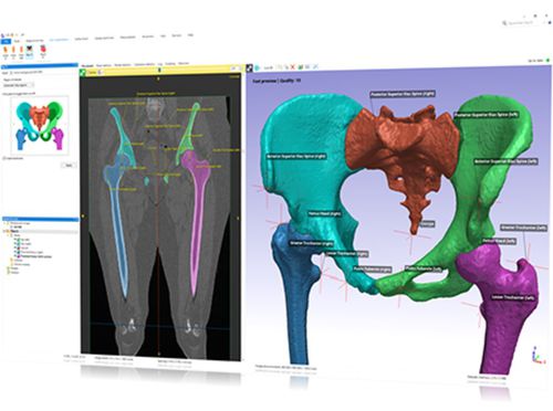 Planning software module - Simpleware Automated Solution  - Synopsys Simpleware Product Group - design / machine learning / medical