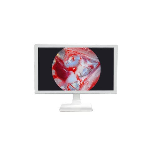 Medical display - TU-24M1080P - Shenzhen Tuyou Medical Imaging Co., Ltd.​ - operating room / surgical / 27"