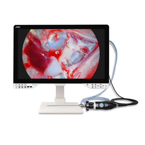Endoscope camera - TU-27LSD1A - Shenzhen Tuyou Medical Imaging Co., Ltd.​ - medical / digital / high-definition