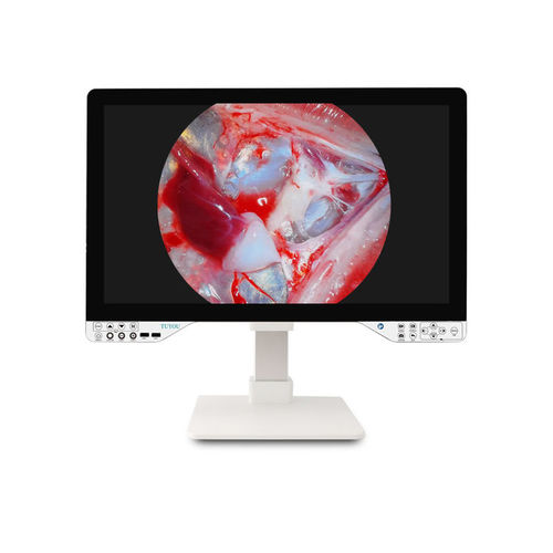 Endoscope camera - TU-27LSD2B - Shenzhen Tuyou Medical Imaging Co., Ltd.​ - digital / VGA / high-definition