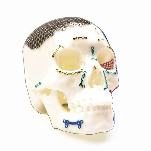 non-absorbable cranial fixation system - Suzhou Kangli Orthopaedics Instrument