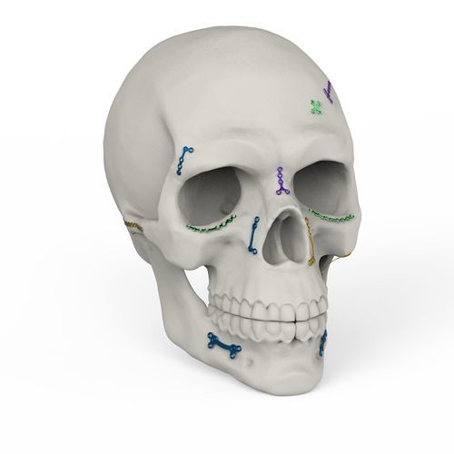 Non-absorbable cranial fixation system - MCF - Kangli Medical