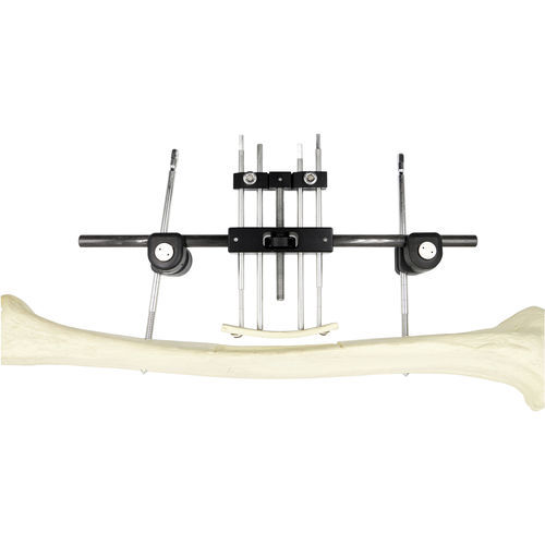 Femur external fixation system - Chongqing FWS Medical Device - tubular / adult