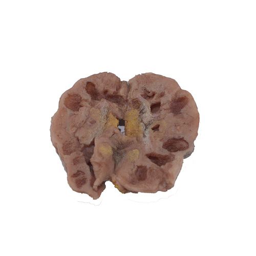 Kidney model - PM-001 - MeiWo Science - for health education / for teaching / for cancers