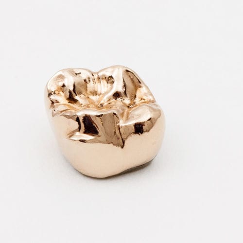 Gold dental prosthesis - DPM Argenco Y+ - Argen - prefabricated