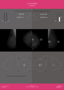 mammography medical software - Hera-MI