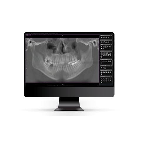 DICOM viewer - FireVIEW DENTAL - Firethunder