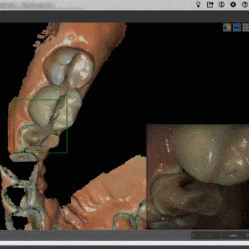 Diagnostic software - Biotec - BTK - CAD / modeling / CAM