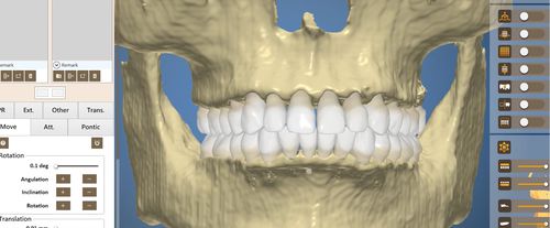 Dental software - OrthoAnalysis - Inteware Co., Ltd - analysis / treatment / treatment planning