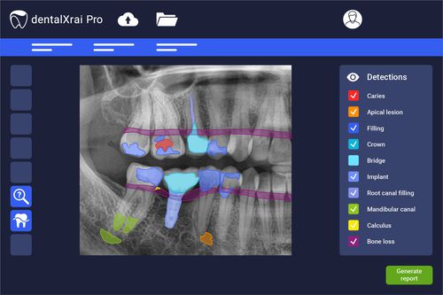Analysis software - dentalXrai Pro 3.0 - dentalXrai GmbH - evaluation / medical / dental