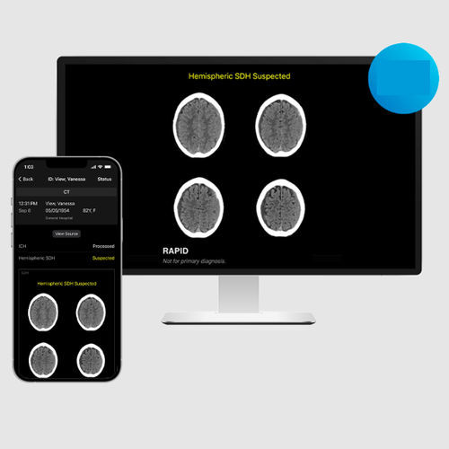 Treatment software - SDH - RapidAI - medical / hospital / CT