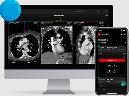 Viewer software - PE - RapidAI - diagnostic / treatment / medical