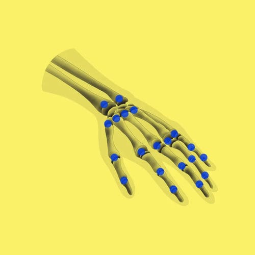 Medical software - BoneAge - Gleamer - clinical / pediatric / bone