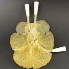 Circulus arteriosus Willisii anatomical model - AM20CW  - Samed - neurosurgery / training / semi-transparent