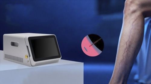 Varicose vein treatment laser - EVLA - Miramhoo Aesthetics - diode / tabletop