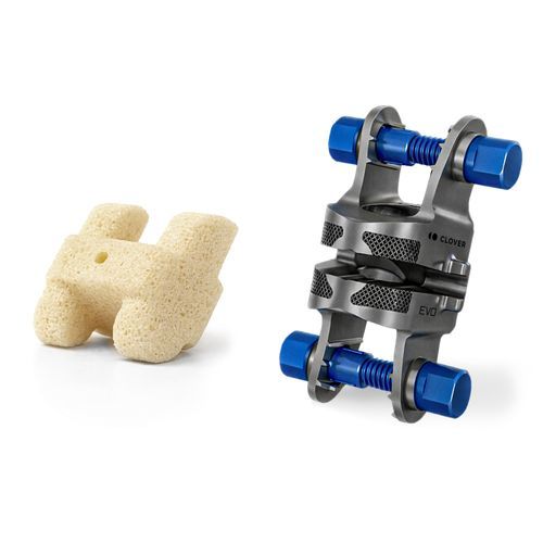 Interlaminar spinal fusion system - Evo  - Clover Next - lateral / adult