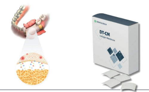 Buccal tissue membrane - DT-CM - DENTAL TECH S.R.L. - collagen / absorbable
