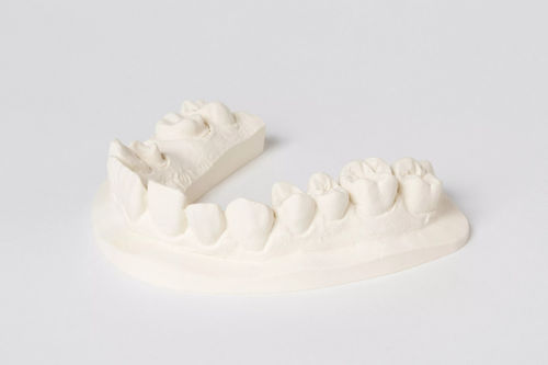Stone dental material - esthetic-base® B.C.  - Dentona AG - for impression trays / modeling