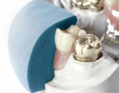 Silicone dental material - gum 85  - Dentona AG - modeling