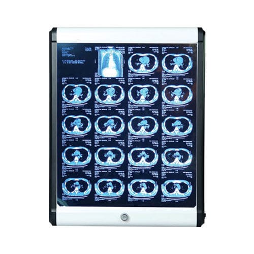 1-screen X-ray film viewer - SSMEC-VB-100 - Samsung Medi Engineering