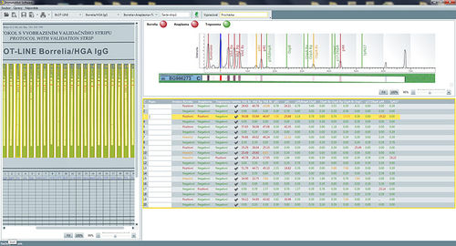 Analysis software - SwIm03 - TestLine Clinical Diagnostics - medical / laboratory / for immunoblot