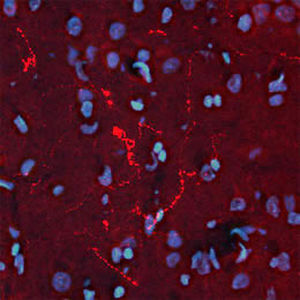 Beta-endorphin reagent - RA21004 - Neuromics - polyclonal antibody / IgG / for scientific research